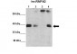 HNRPA0 antibody - middle region
